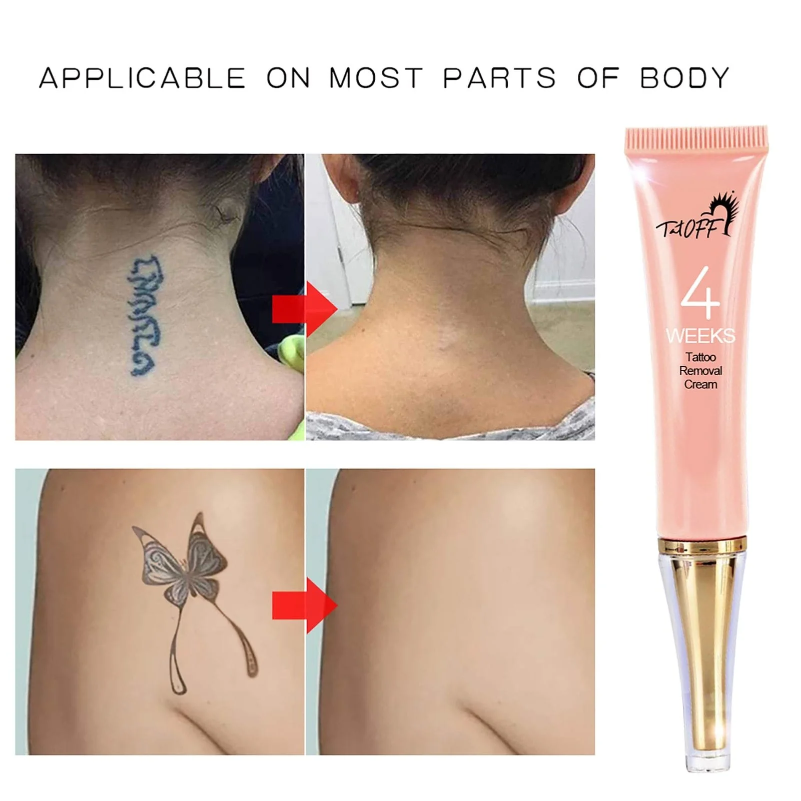 Someone Has Invented a Painless Tattoo Removal Cream – YouBeauty